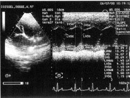 >Herzultraschalldiagnostik